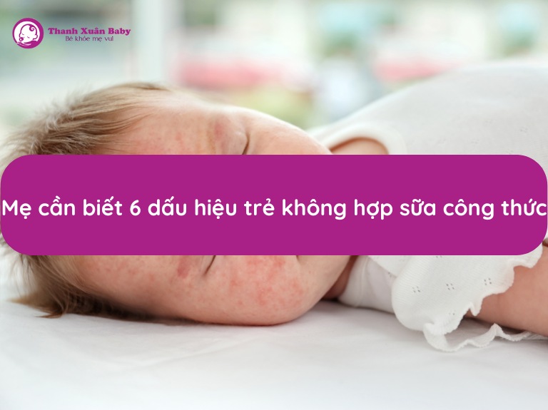 6-dau-hieu-tre-khong-hop-sua-cong-thuc-me-can-biet