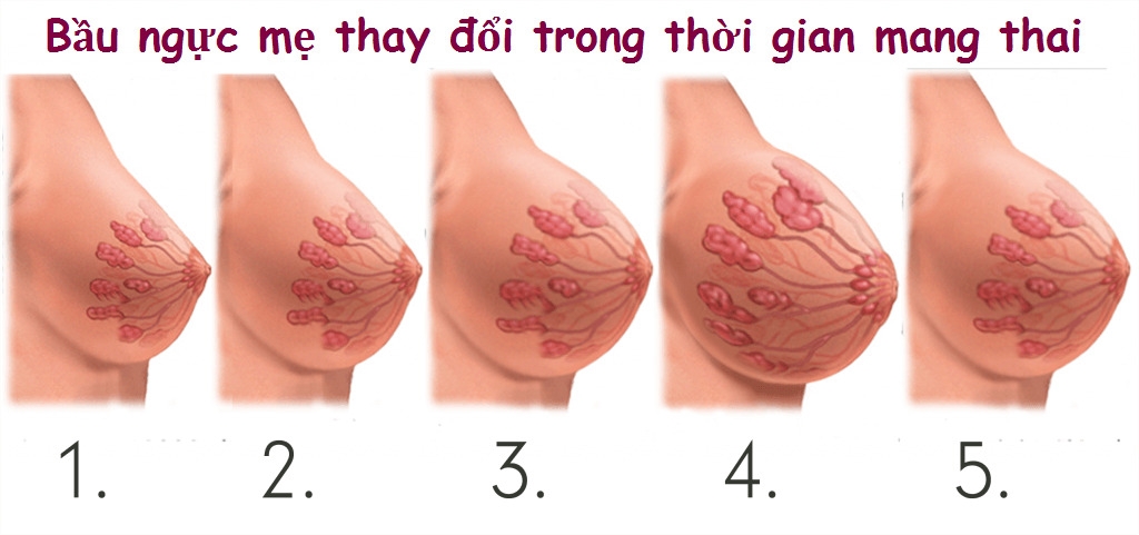 1. Thay Đổi Ngực Khi Mang Thai