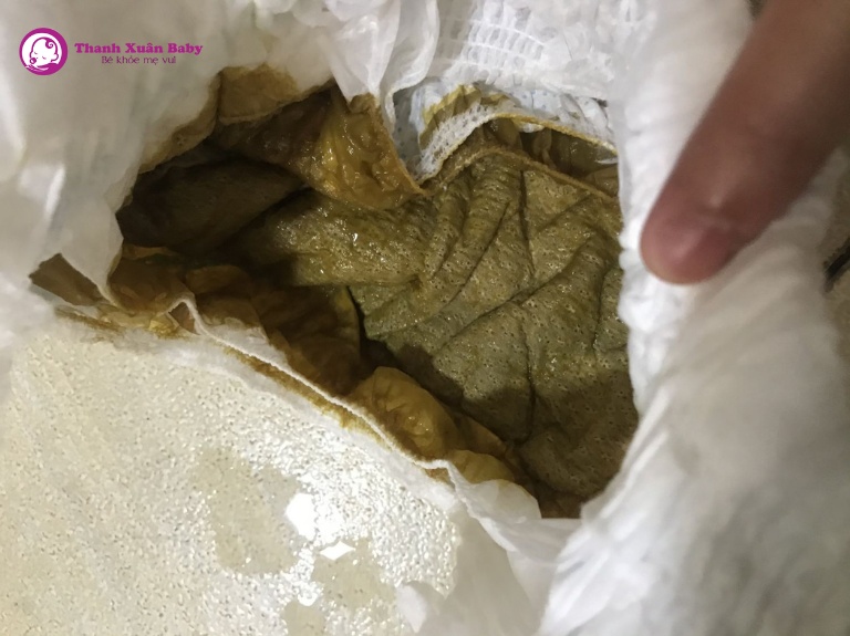 Nguyên nhân trẻ uống sữa công thức đi ngoài phân xanh rêu